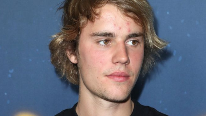 Instagram Justin Bieber Se Une A La Tendencia De Mostrar Su Acné [video]