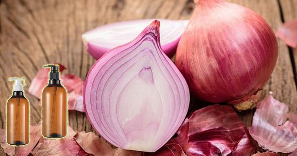 Champú de cebolla conoce sus beneficios para un cabello fuerte